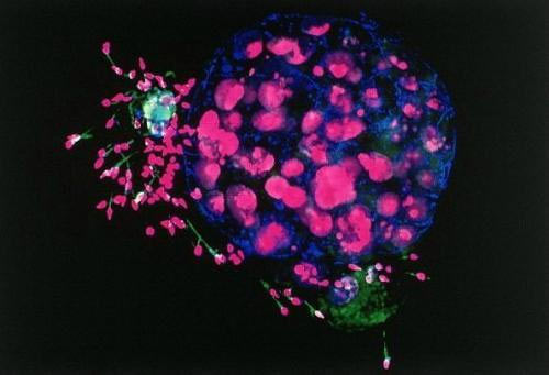 ���δ������������ͼƬ  ����ϸ��ͼ